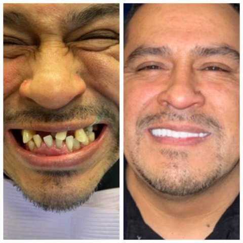 Patinet Transformation Image