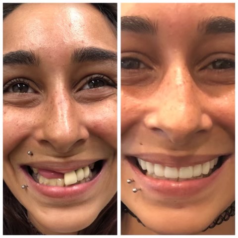 Patinet Transformation Image