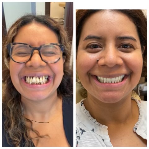 Patinet Transformation Image