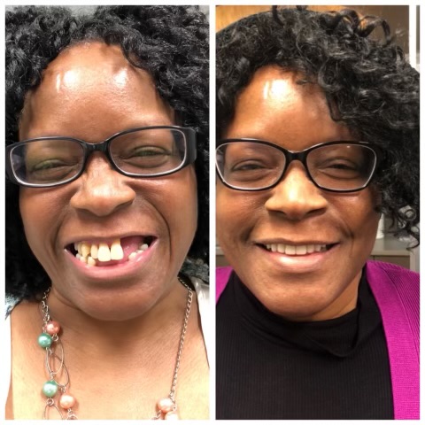Patinet Transformation Image