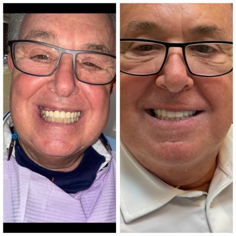 Patinet Transformation Image