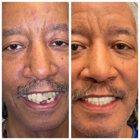 Patinet Transformation Image