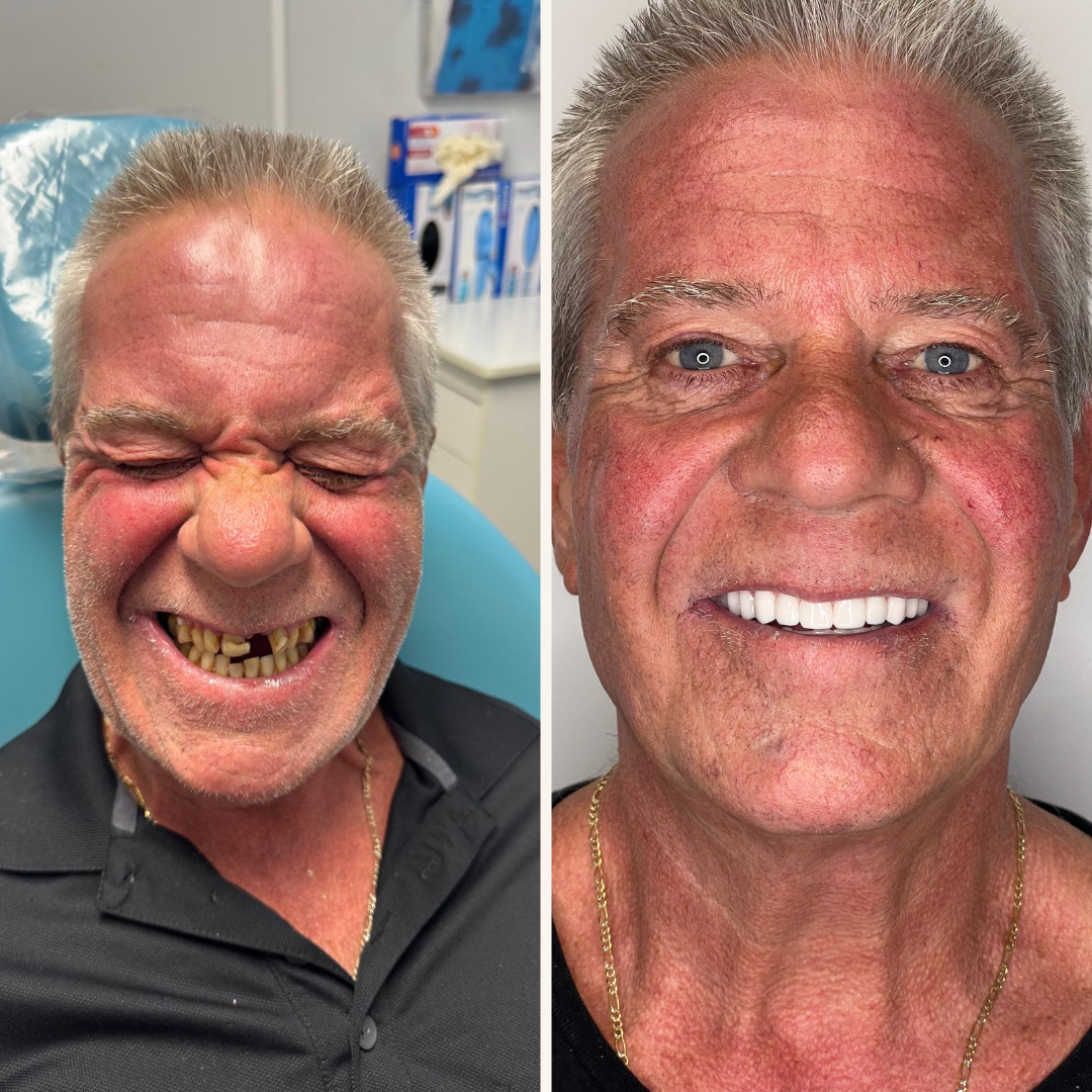 Patinet Transformation Image