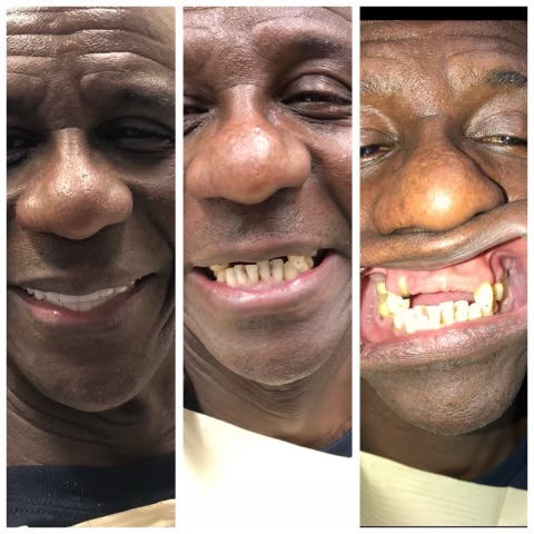 Patinet Transformation Image