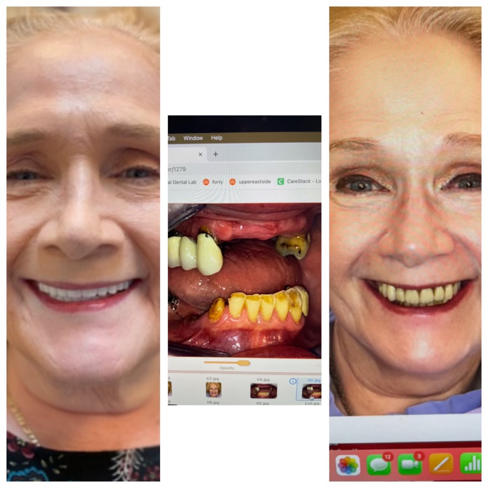 Patinet Transformation Image