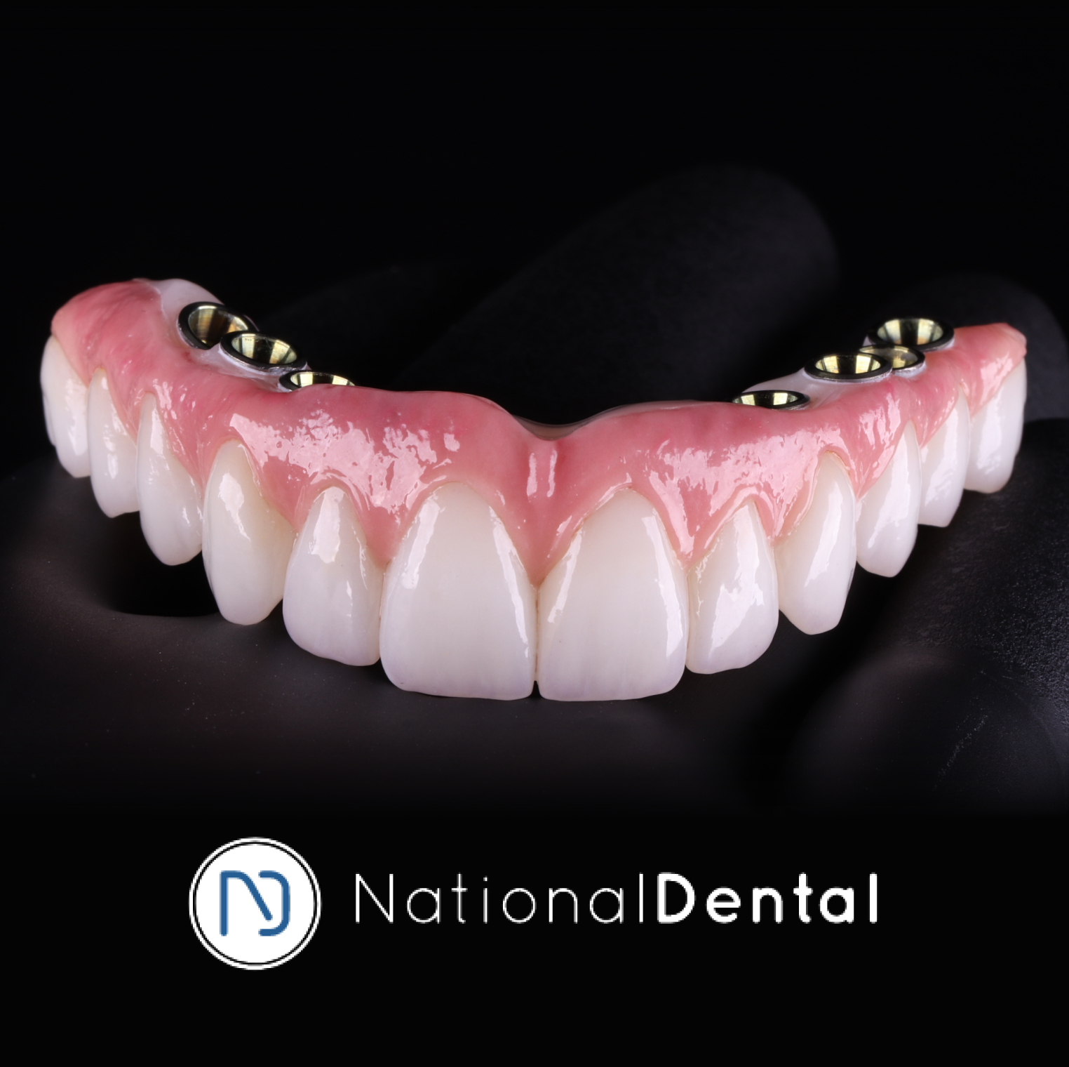 Hybrid Implant Bridge
